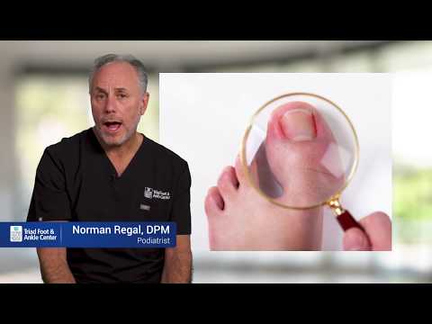 Ask The Doctor: The Skin Around My Nail is Red & Swollen